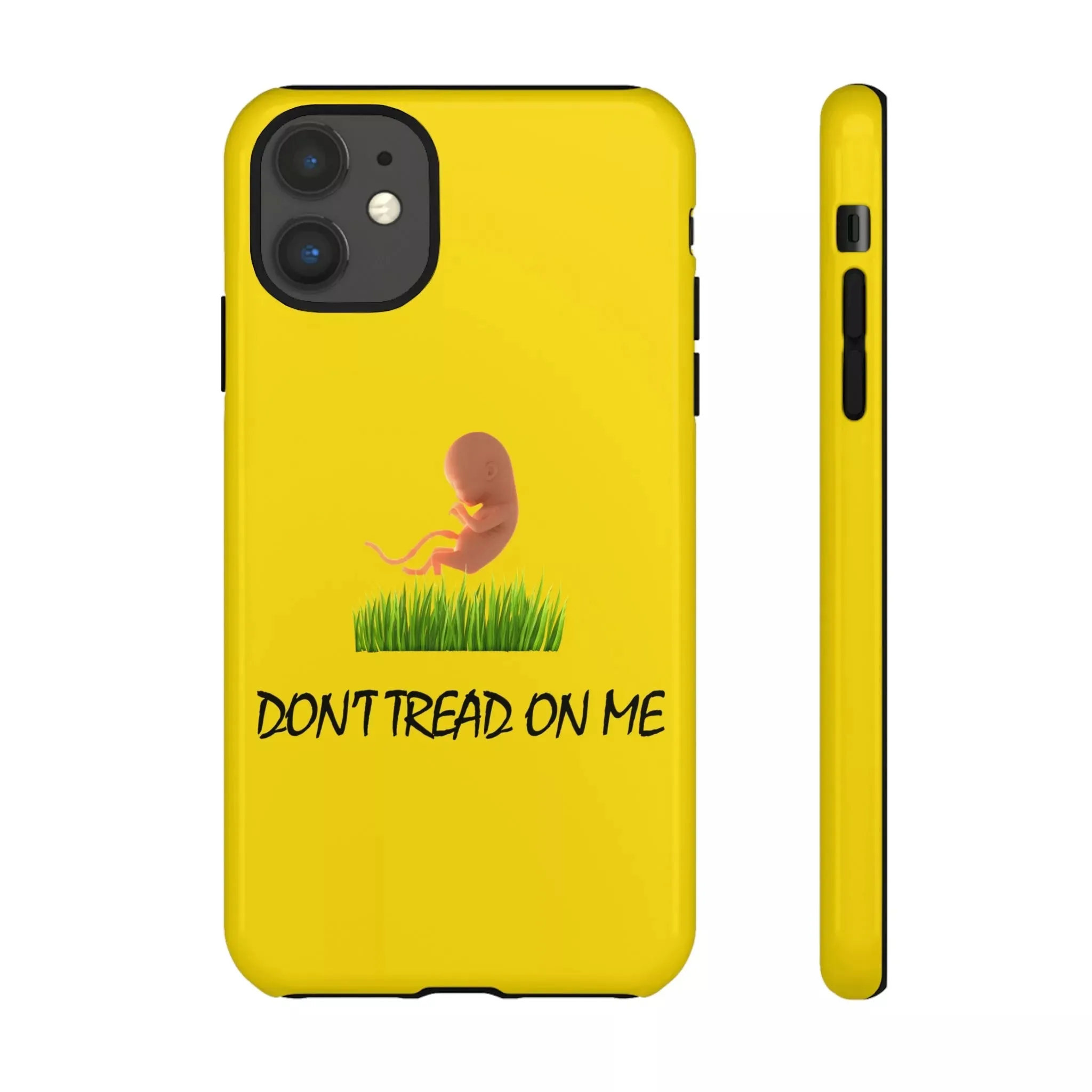 Don't Tread on Baby Phone Case