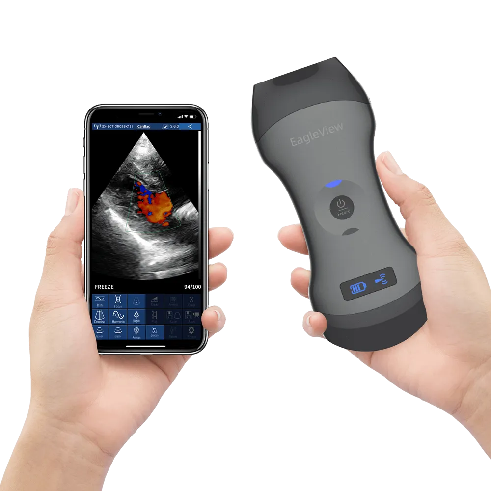 EagleView™ Dual-head Wireless Handheld Ultrasound